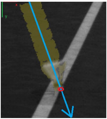 computer vision system